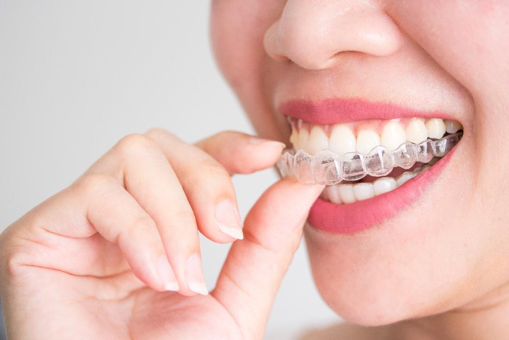 close up of woman using invisalign