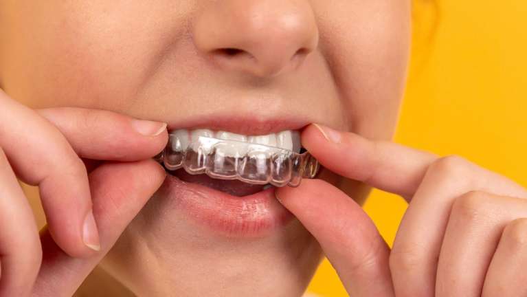 woman using invisalign aligners 