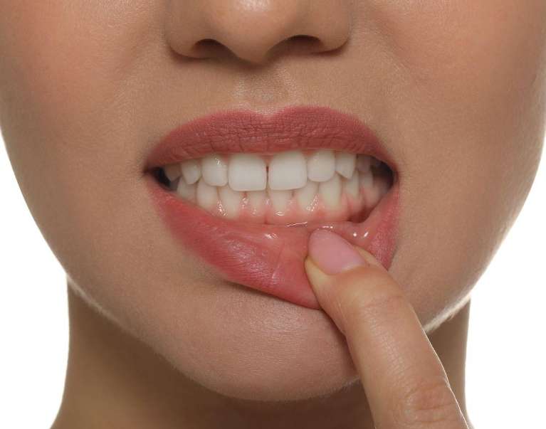 close up of person pointing to gums