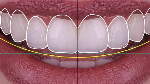digital smile design in brisbane