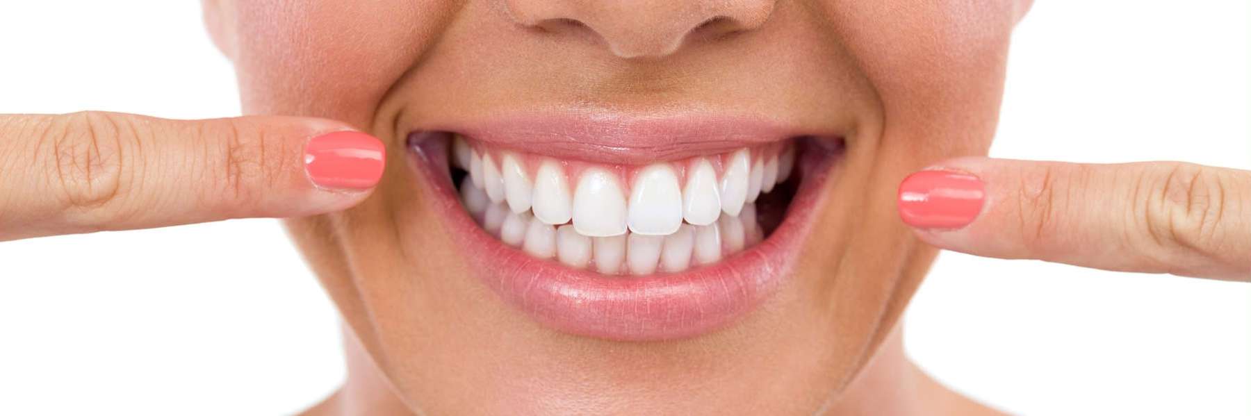 brisbane woman pointing to her smile