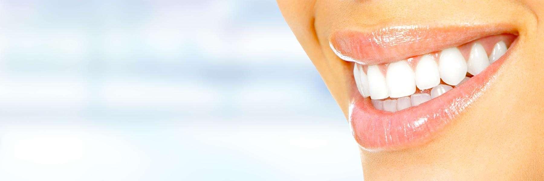 Patient's smile after professional teeth whitening in Brisbane