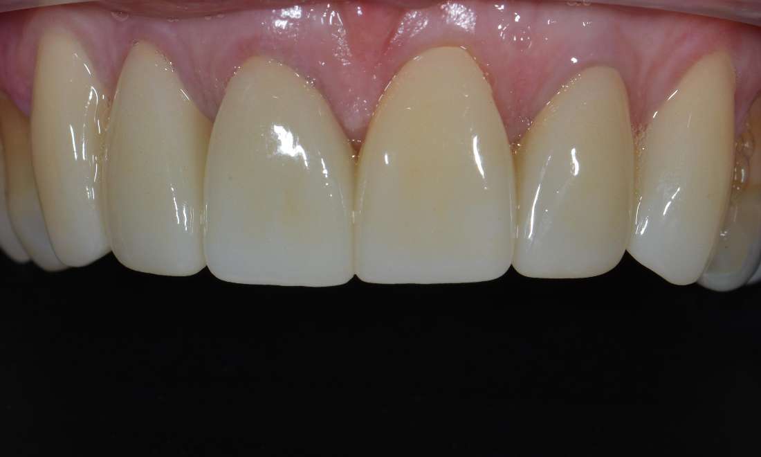 Brisbane new Crowns After