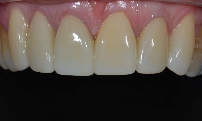 Brisbane new Crowns After