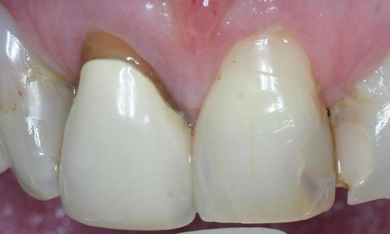 Brisbane old Crowns Before