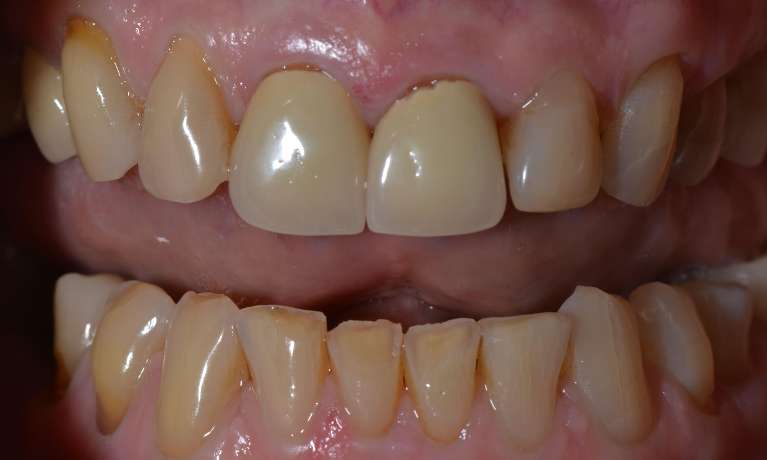 Brisbane Cosmetic Dentist