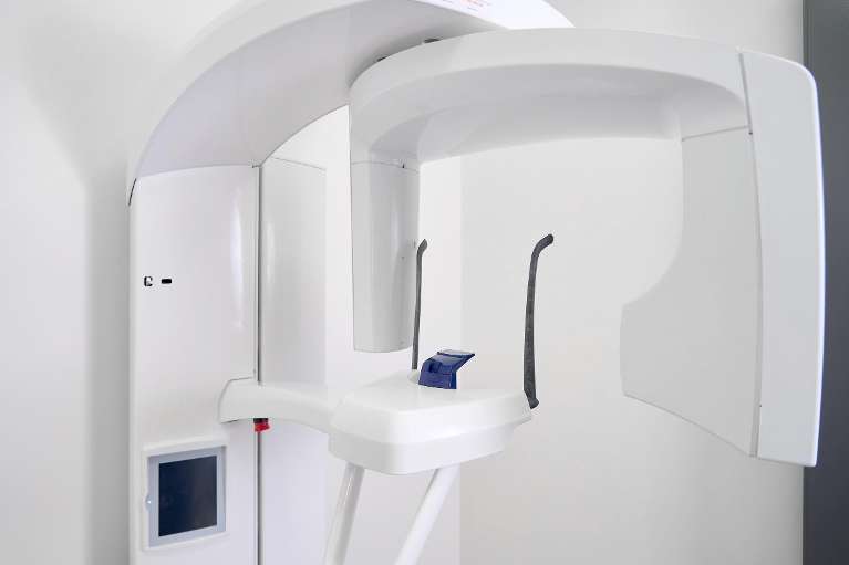 Digital dental x-rays